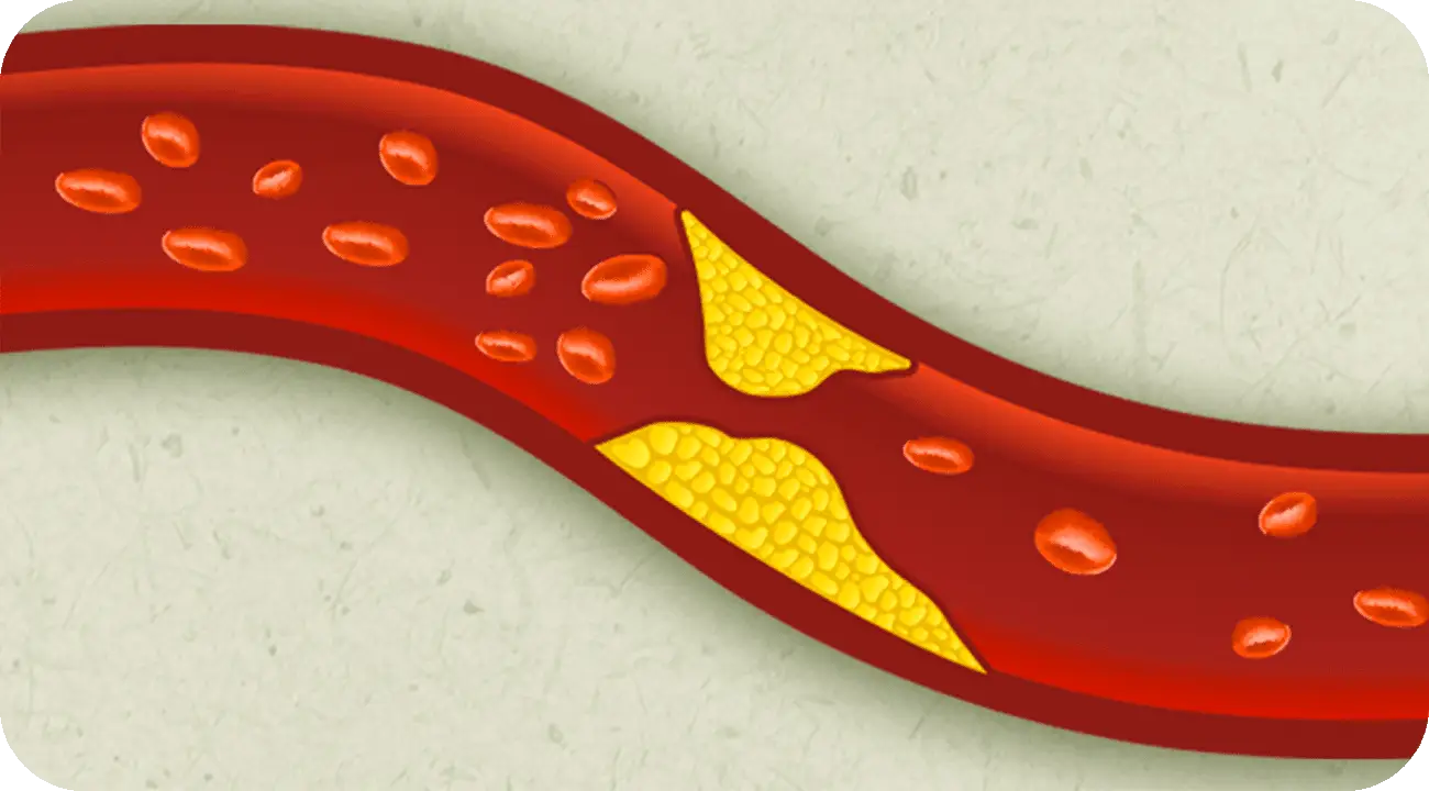 Blocco circolatorio: cause, sintomi da riconoscere subito e cosa fare
