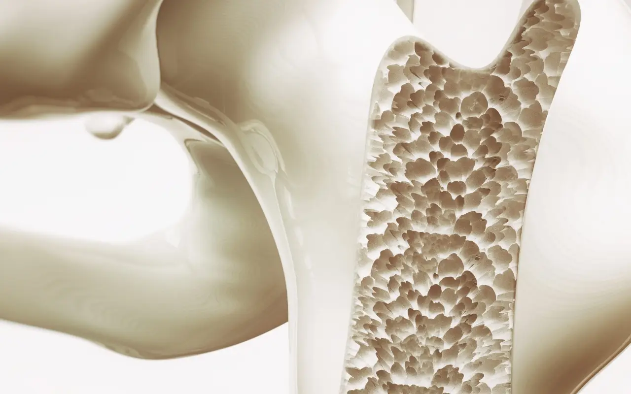 Soffri di osteoporosi? Ecco cosa dice la scienza sull’efficacia della magnetoterapia